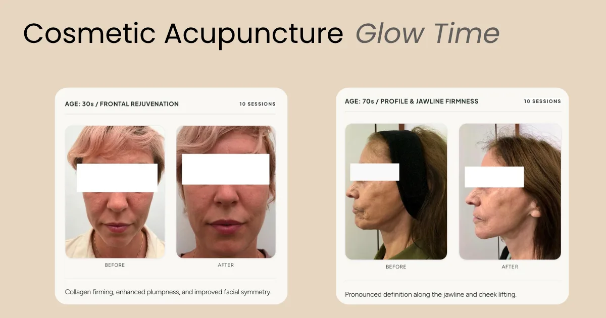 Acupuncture In Lisbon, foto 5